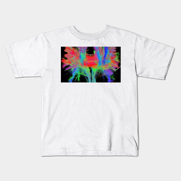 Corpus callosum, DTI MRI scan (C017/7044) Kids T-Shirt by SciencePhoto